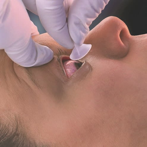 Øyeskyllelinse Morgan