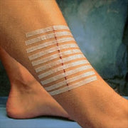 Sutur tape Steri-strip 6x100mm 10 stk