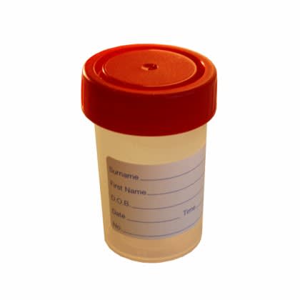 Urinprøvebeger 60ml/m lokk og etikett